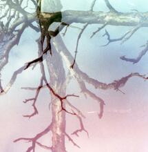 Mikrodosierung von Cannabis stoppt Alzheimer-Verfall laut neuer Studie