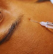 Czy botoks i marihuana to bezpieczne połączenie?