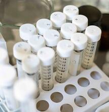 Researchers at the University of Chile have developed a CBD nanoemulsion that successfully reduced malignant tumor cells in an in vitro model.