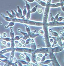 Trichoderma. Naturalna pomoc w zdrowej uprawie