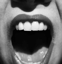 Tips on How to Handle Cottonmouth