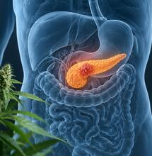 Cannabis medicinal y cáncer de páncreas