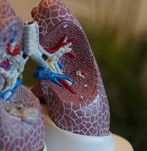Smoking Marijuana and Lung Health: Is There A Relationship?
