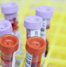 test tubes in the lab with blood samples.