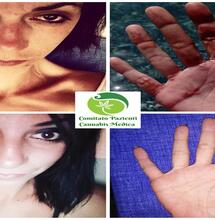 La cannabis medica è un’urgenza