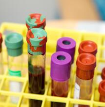 blood samples