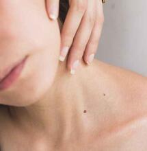 Cannabinoides y enfermedades inflamatorias de la piel