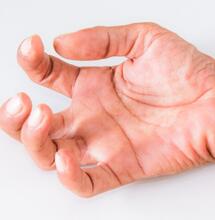 Sativex a spasticita při chronickém poranění míchy