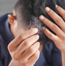 Cannabis y la caída del cabello