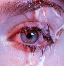 Warum kann man vom Kiffen rote Augen bekommen