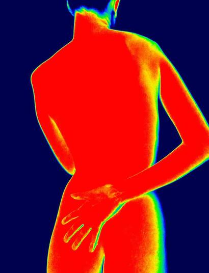 CBDV (Cannabidivarin) and CBG (Cannabigerol) are lesser-known compounds found in cannabis that may offer significant anti-inflammatory benefits