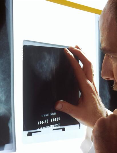 Cannabis en el Tratamiento del Cáncer de Próstata