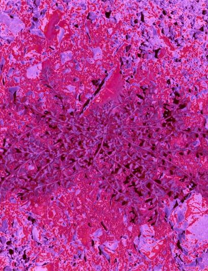 Cannabistherapie bei Fibromyalgie