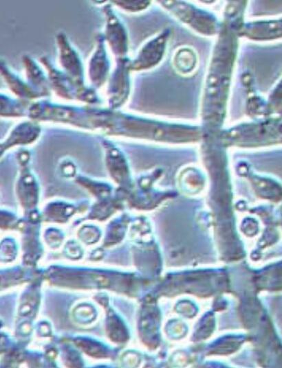 Trichoderma