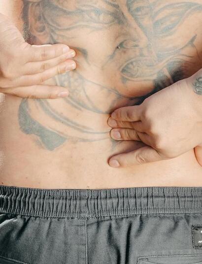 Cannabis contra el dolor lumbar neuropático.