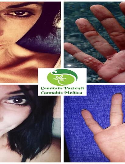 La cannabis medica è un’urgenza