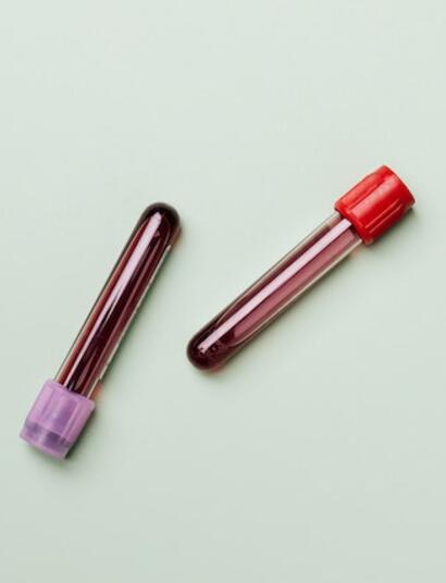 blood vials
