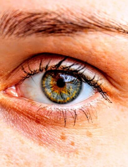 ¿Por qué los ojos rojos al fumar? Y cómo blanquearlos
