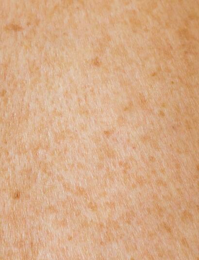 piel