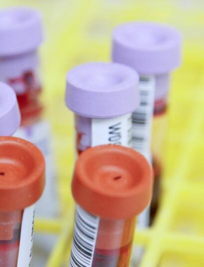 ¿Cómo funcionan los test de marihuana?