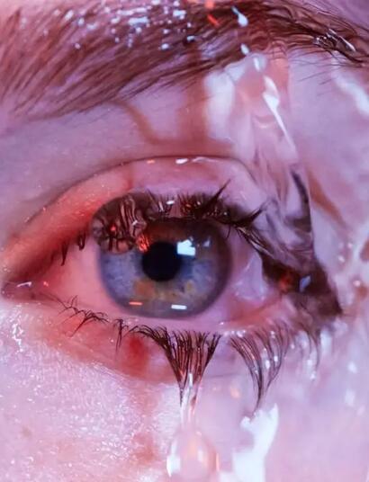 Warum kann man vom Kiffen rote Augen bekommen