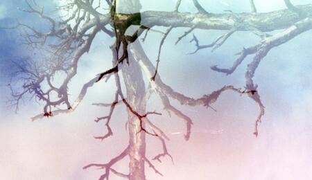 Cannabis Mikrodosierung bei Alzheimer: Neue Studienergebnisse.