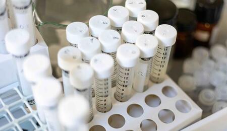 Researchers at the University of Chile have developed a CBD nanoemulsion that successfully reduced malignant tumor cells in an in vitro model.