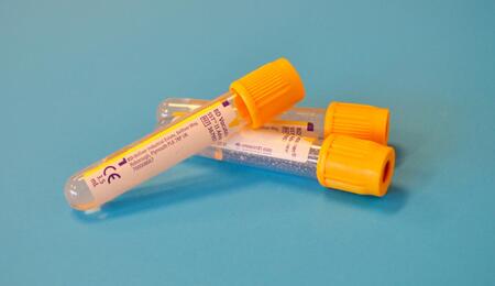 blood tubes for blood tests.