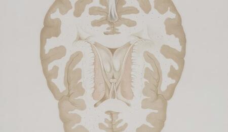 cerebro