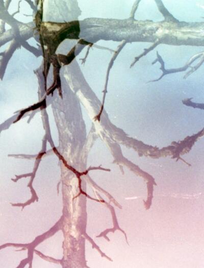 Cannabis Mikrodosierung bei Alzheimer: Neue Studienergebnisse.