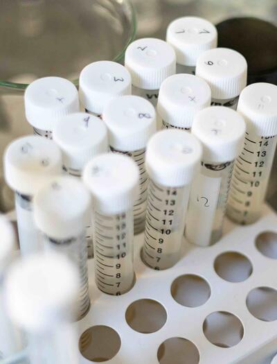 Researchers at the University of Chile have developed a CBD nanoemulsion that successfully reduced malignant tumor cells in an in vitro model.
