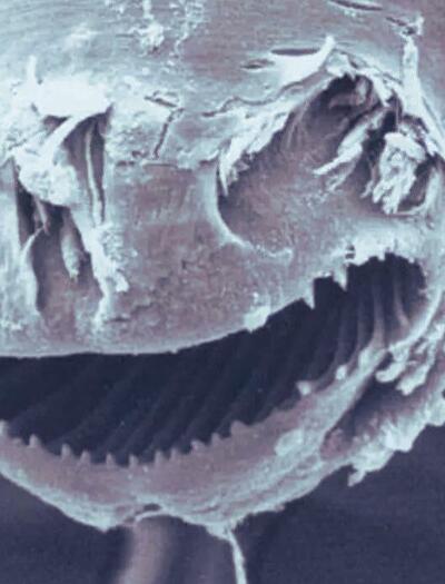 Camallanus cotti