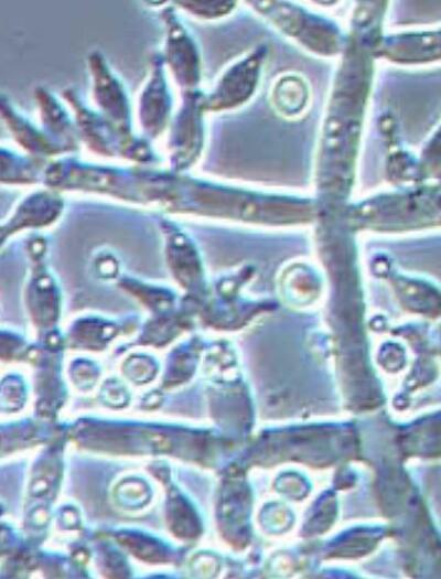 Trichoderma