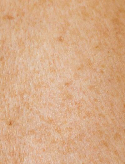 piel