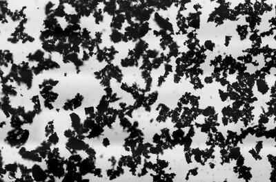 A micrograph showing how activated charcoal looks in water. 