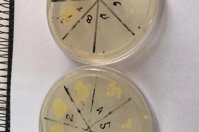 microorganismos-análisis